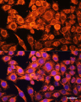 Immunofluorescence analysis of HeLa cells using AMPKa1/AMPKa2 Polyclonal Antibody at dilution of 1:100 (40x lens) . Blue: DAPI for nuclear staining.