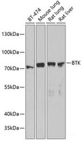 Western blot analysis of extracts of various cell lines using BTK Polyclonal Antibody at dilution of 1:1000.