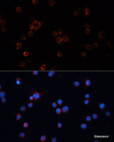 Immunofluorescence analysis of Jurkat cells using TH Polyclonal Antibody at dilution of 1:100 (40x lens) . Blue: DAPI for nuclear staining.