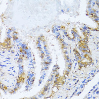 Immunohistochemistry of paraffin-embedded Rat lung using NAT2 Polyclonal Antibody at dilution of 1:100 (40x lens) .