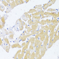 Immunohistochemistry of paraffin-embedded Rat heart using NAT2 Polyclonal Antibody at dilution of 1:100 (40x lens) .