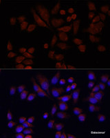 Immunofluorescence analysis of 293T cells using NAT2 Polyclonal Antibody at dilution of 1:100 (40x lens) . Blue: DAPI for nuclear staining.