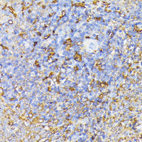 Immunohistochemistry of paraffin-embedded Rat spleen using VEGF Receptor 1 Polyclonal Antibody at dilution of 1:100 (40x lens) .