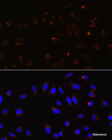 Immunofluorescence analysis of U-2 OS cells using Mitofusin 2 Polyclonal Antibody at dilution of 1:100. Blue: DAPI for nuclear staining.