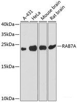 Western blot analysis of extracts of various cell lines using RAB7A Polyclonal Antibody at dilution of 1:3000.