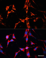 Immunofluorescence analysis of NIH/3T3 cells using RAB7A Polyclonal Antibody at dilution of 1:100. Blue: DAPI for nuclear staining.