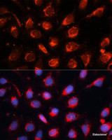 Immunofluorescence analysis of U-2OS cells using RAB7A Polyclonal Antibody at dilution of 1:100. Blue: DAPI for nuclear staining.