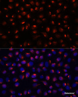 Immunofluorescence analysis of HeLa cells using ACTN3 Polyclonal Antibody at dilution of 1:100 (40x lens) . Blue: DAPI for nuclear staining.