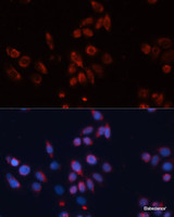 Immunofluorescence analysis of HeLa cells using GPC4 Polyclonal Antibody at dilution of 1:100. Blue: DAPI for nuclear staining.