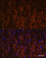 Immunofluorescence analysis of Mouse brain using SNX13 Polyclonal Antibody at dilution of 1:100. Blue: DAPI for nuclear staining.