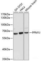 Western blot analysis of extracts of various cell lines using PPM1J Polyclonal Antibody at dilution of 1:3000.