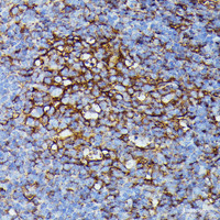 Immunohistochemistry of paraffin-embedded Mouse spleen using HLA-B Polyclonal Antibody at dilution of 1:100 (40x lens) .