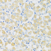 Immunohistochemistry of paraffin-embedded Human stomach using C1GALT1 Polyclonal Antibody at dilution of 1:100 (40x lens) .