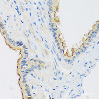 Immunohistochemistry of paraffin-embedded Mouse lung using C1GALT1 Polyclonal Antibody at dilution of 1:100 (40x lens) .