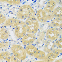 Immunohistochemistry of paraffin-embedded Mouse kidney using C1GALT1 Polyclonal Antibody at dilution of 1:100 (40x lens) .