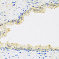 Immunohistochemistry of paraffin-embedded Human prostate using LIF Polyclonal Antibody at dilution of 1:100 (40x lens) .