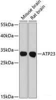 Western blot analysis of extracts of various cell lines using ATP23 Polyclonal Antibody at dilution of 1:3000.