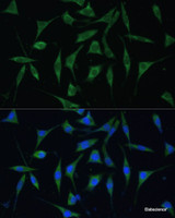 Immunofluorescence analysis of L929 cells using PALD1 Polyclonal Antibody at dilution of 1:100 (40x lens) . Blue: DAPI for nuclear staining.