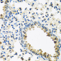 Immunohistochemistry of paraffin-embedded Mouse lung using IFNL3 Polyclonal Antibody at dilution of 1:100 (40x lens) .