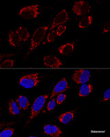 Confocal immunofluorescence analysis of U2OS cells using MRPS31 Polyclonal Antibody at dilution of 1:200. Blue: DAPI for nuclear staining.