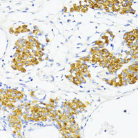 Immunohistochemistry of paraffin-embedded Rat ovary using Fibronectin Polyclonal Antibody at dilution of 1:100 (40x lens) .