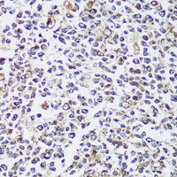 Immunohistochemistry of paraffin-embedded Human tonsil using ECH1 Polyclonal Antibody at dilution of 1:150 (40x lens) .