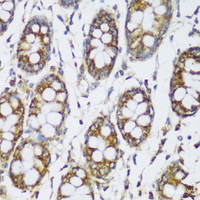 Immunohistochemistry of paraffin-embedded Human colon using ECH1 Polyclonal Antibody at dilution of 1:150 (40x lens) .