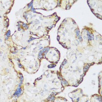 Immunohistochemistry of paraffin-embedded Human placenta using ECH1 Polyclonal Antibody at dilution of 1:150 (40x lens) .