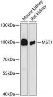 Western blot analysis of extracts of various cell lines using MST1 Polyclonal Antibody at dilution of 1:3000.
