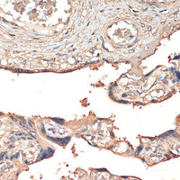 Immunohistochemistry of paraffin-embedded Human placenta using MST1 Polyclonal Antibody at dilution of 1:200 (40x lens) .