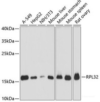 Western blot analysis of extracts of various cell lines using RPL32 Polyclonal Antibody at dilution of 1:3000.