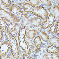 Immunohistochemistry of paraffin-embedded Rat kidney using HAL Polyclonal Antibody at dilution of 1:100 (40x lens) .
