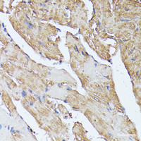 Immunohistochemistry of paraffin-embedded Mouse heart using HAL Polyclonal Antibody at dilution of 1:100 (40x lens) .
