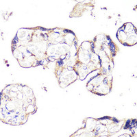 Immunohistochemistry of paraffin-embedded Human placenta using IGF2R Polyclonal Antibody at dilution of 1:100 (40x lens) .