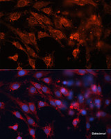 Immunofluorescence analysis of C6 cells using IGF2R Polyclonal Antibody at dilution of 1:100. Blue: DAPI for nuclear staining.