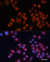 Immunofluorescence analysis of HeLa cells using IGF2R Polyclonal Antibody at dilution of 1:100. Blue: DAPI for nuclear staining.