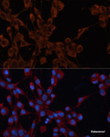 Immunofluorescence analysis of NIH/3T3 cells using IGF2R Polyclonal Antibody at dilution of 1:100. Blue: DAPI for nuclear staining.