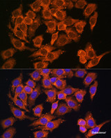 Immunofluorescence analysis of HeLa cells using MYO6 Polyclonal Antibody at dilution of 1:100. Blue: DAPI for nuclear staining.