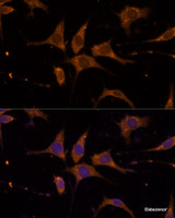 Immunofluorescence analysis of L929 cells using RPL27 Polyclonal Antibody at dilution of 1:100 (40x lens) . Blue: DAPI for nuclear staining.