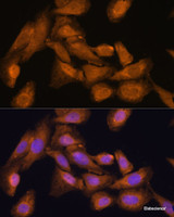 Immunofluorescence analysis of U-2 OS cells using RPL27 Polyclonal Antibody at dilution of 1:100 (40x lens) . Blue: DAPI for nuclear staining.