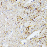 Immunohistochemistry of paraffin-embedded Rat brain using TBCA Polyclonal Antibody at dilution of 1:100 (40x lens) .