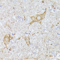 Immunohistochemistry of paraffin-embedded Mouse spinal cord using TBCA Polyclonal Antibody at dilution of 1:100 (40x lens) .