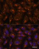 Immunofluorescence analysis of U-2 OS cells using IFITM3 Polyclonal Antibody at dilution of 1:100. Blue: DAPI for nuclear staining.