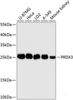 Western blot analysis of extracts of various cell lines using PRDX3 Polyclonal Antibody at dilution of 1:3000.
