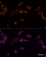Immunofluorescence analysis of NIH-3T3 cells using PRDX3 Polyclonal Antibody at dilution of 1:100 (40x lens) . Blue: DAPI for nuclear staining.