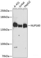 Western blot analysis of extracts of various cell lines using NUP160 Polyclonal Antibody at dilution of 1:3000.