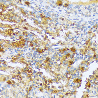 Immunohistochemistry of paraffin-embedded Rat ovary using A1CF Polyclonal Antibody at dilution of 1:100 (40x lens) .