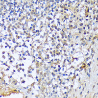 Immunohistochemistry of paraffin-embedded Human tonsil using A1CF Polyclonal Antibody at dilution of 1:100 (40x lens) .