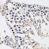 Immunohistochemistry of paraffin-embedded Rat testis using CASC5 Polyclonal Antibody at dilution of 1:100 (40x lens) .