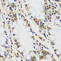 Immunohistochemistry of paraffin-embedded Human colon using CASC5 Polyclonal Antibody at dilution of 1:100 (40x lens) .